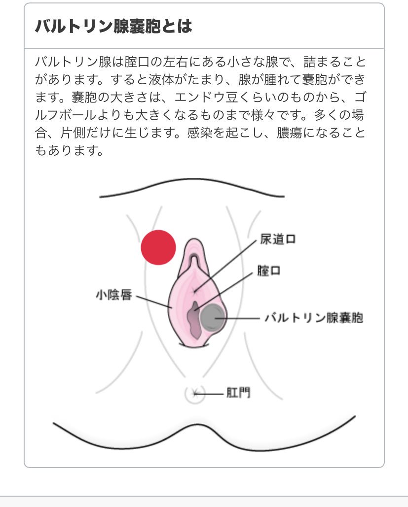 大 唇 陰 腫れ 痛み