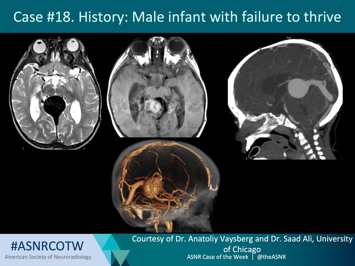 The American Society of Neuroradiology tweet media