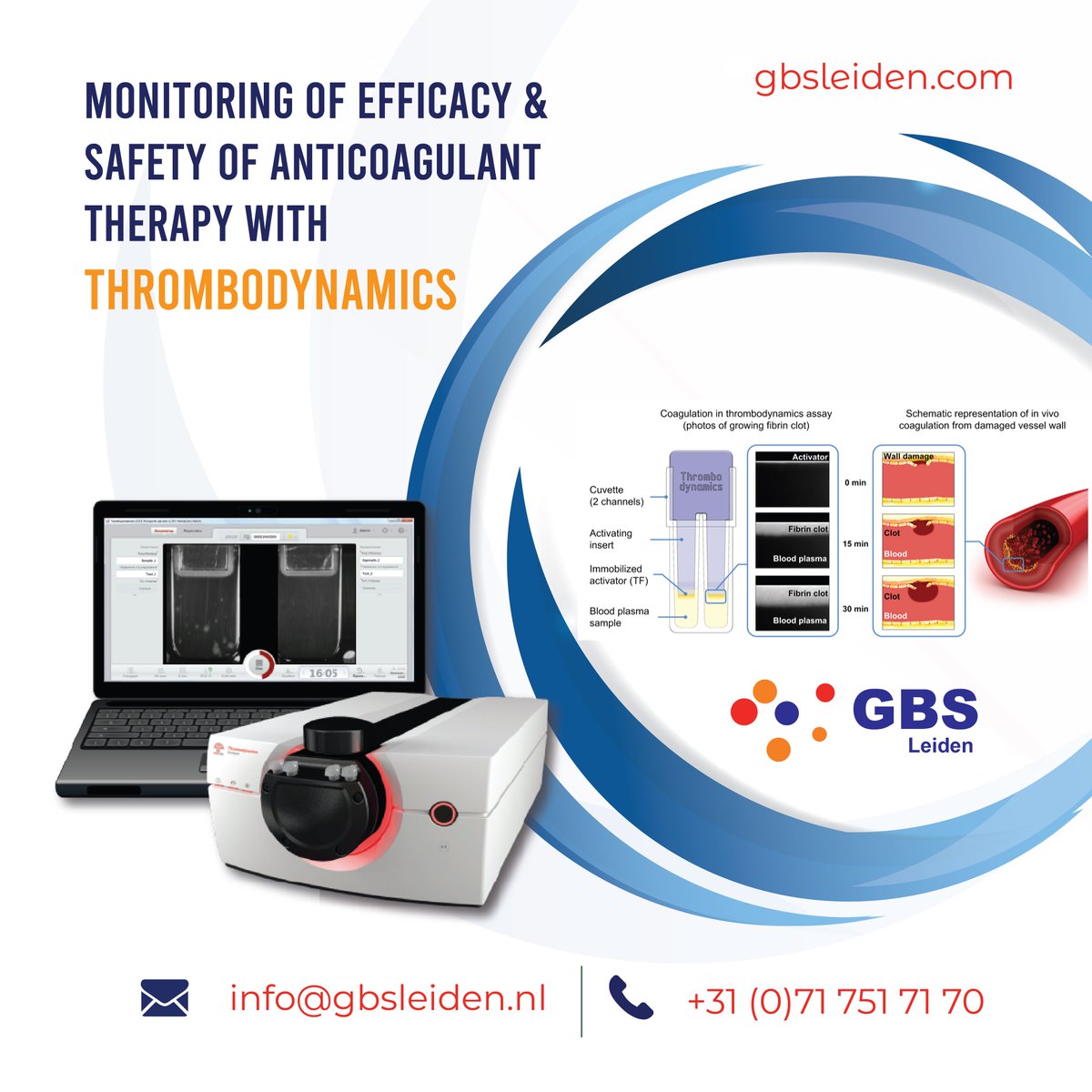 Thrombodynamics: novel and more #physiologic_global_hemostasis_test that reveals the participation of clotting factors during the clot growth. #GBS_Leiden is a leader in analysis of #thrombodynamics. Interested to look at more than clotting time? visit gbsleiden.com