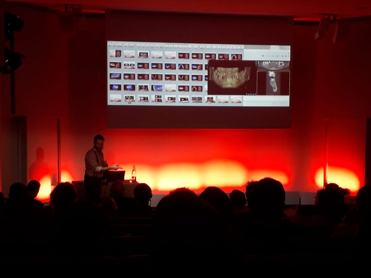 Nemotec (@nemotec) on Twitter photo Dsd Course Biotech Paris with Dr Christian Coachman
#NemoSmileDesign #DSD #NemoCast #NemoScan #Nemotec #Biotech #aestheticdentistry #digitalsmiledesign Dsd Course Biotech Paris with Dr Christian Coachman
#NemoSmileDesign #DSD #NemoCast #NemoScan #Nemotec #Biotech #aestheticdentistry #digitalsmiledesign