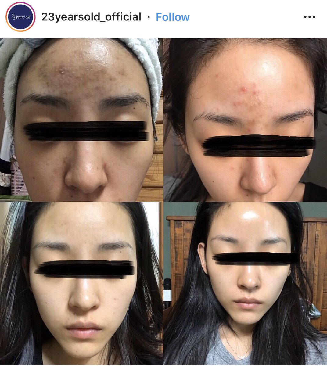 multyshopping's tweet photo. #แจกแจก อยากแจกครีมดังจากเกาหลี Badecasil Cream ของ23yearsold รีวิวเกาหลีว่าขึ้นชื่อเรื่องสิวยุบไว รอยสิวจางลง หน้านุ่มขึ้น ขายที่ Oliveyoung เกาหลี

สุ่มแจก 2 หลอด กติกา: รี+ฟอลมัลตี้
ประกาศวันจันท���์ที่ 7ตค.นี้ค่า https://t.co/MdvDu04Avz