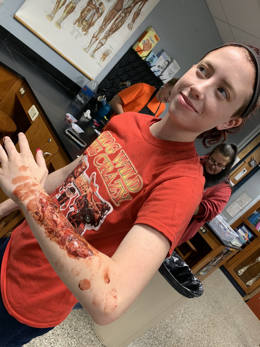 MrsSmith_SCHS's tweet photo. Rough day in the lab today! #integumentary #fakewound #anatomy https://t.co/7yKpGVvDlp