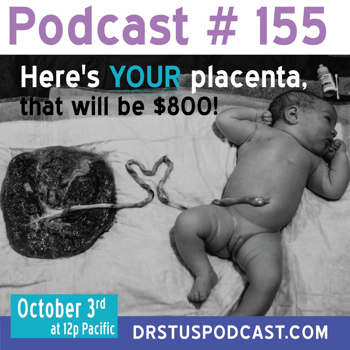 ReteachBreech's tweet image. What's the deal w #placental pathology anyway? From oligohydramnios to home insemination, Blyss &amp;amp; Dr. Stu tackle some really fertile questions. Today at 12p Pacific