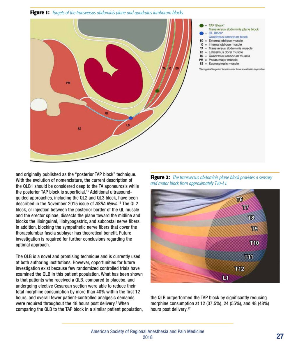 findyourblock's tweet image. page 2 of 3 from ASRA News May 2018 article titled Truncal Blocks for Cesarean Pain #qlblock #regionalanesthesia