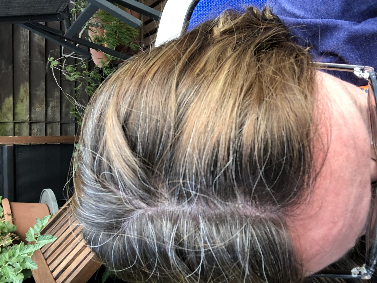 Lee Budgie Barnett On Twitter Pshaw As Someone Who Long Ago