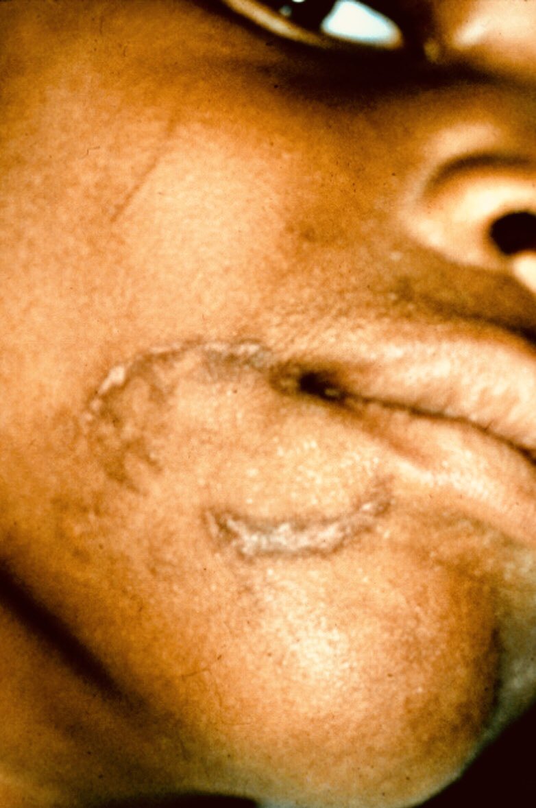 theAFOHR's tweet photo. #AFOHR #FOSGs GOAL 8 #Dentalevidence in crimes against vulnerable persons = provide awareness & pro bono assistance in cases of #childabuse and vulnerable abuse, #torture, domestic violence, sexual abuse, and #THB Trafficking in Human Beings, including #cognitive interviewing. https://t.co/2w46wOCLUY