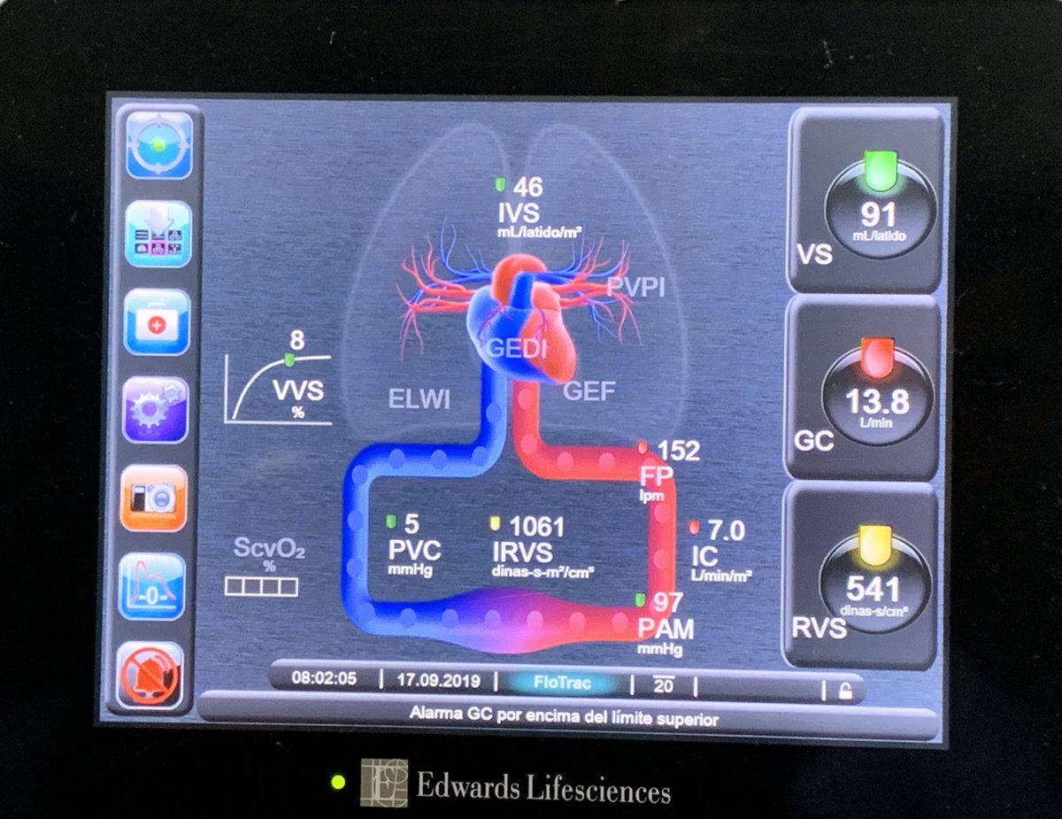 Vasoplejia severa postrauma.
Como tratarla?
No todo paciente de trauma está sangrado. No todos se curan con hemoderivados. Shock por trauma el 5to shock. Inicia desde los primeros minutos.