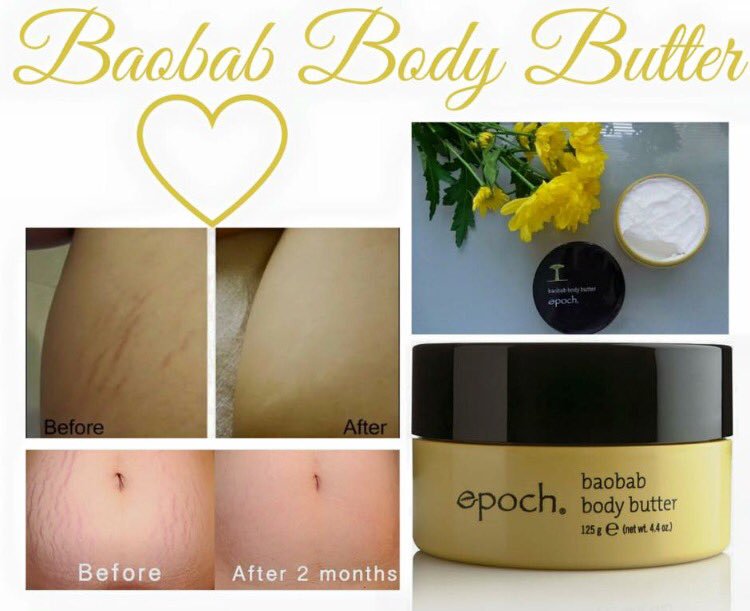 lush products for stretch marks