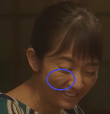シリウス בטוויטר 前から気になってたんだけど 木村文乃 の目の下 鼻横 頬のシワ 何 結構イイトシの自分も含めナチュラルな一般女性 だとこの辺りにこんなシワはないよ 深田恭子 と 鈴木京香 にもあったんだけど ふっくらさせたい シワ伸ばし の シリウス בטוויטר 前から気になってたんだけど 木村文乃 の目の下 鼻横 頬のシワ 何 結構イイトシの自分も含めナチュラルな一般女性 だとこの辺りにこんなシワはないよ 深田恭子 と 鈴木京香 にもあったんだけど ふっくらさせたい シワ伸ばし の