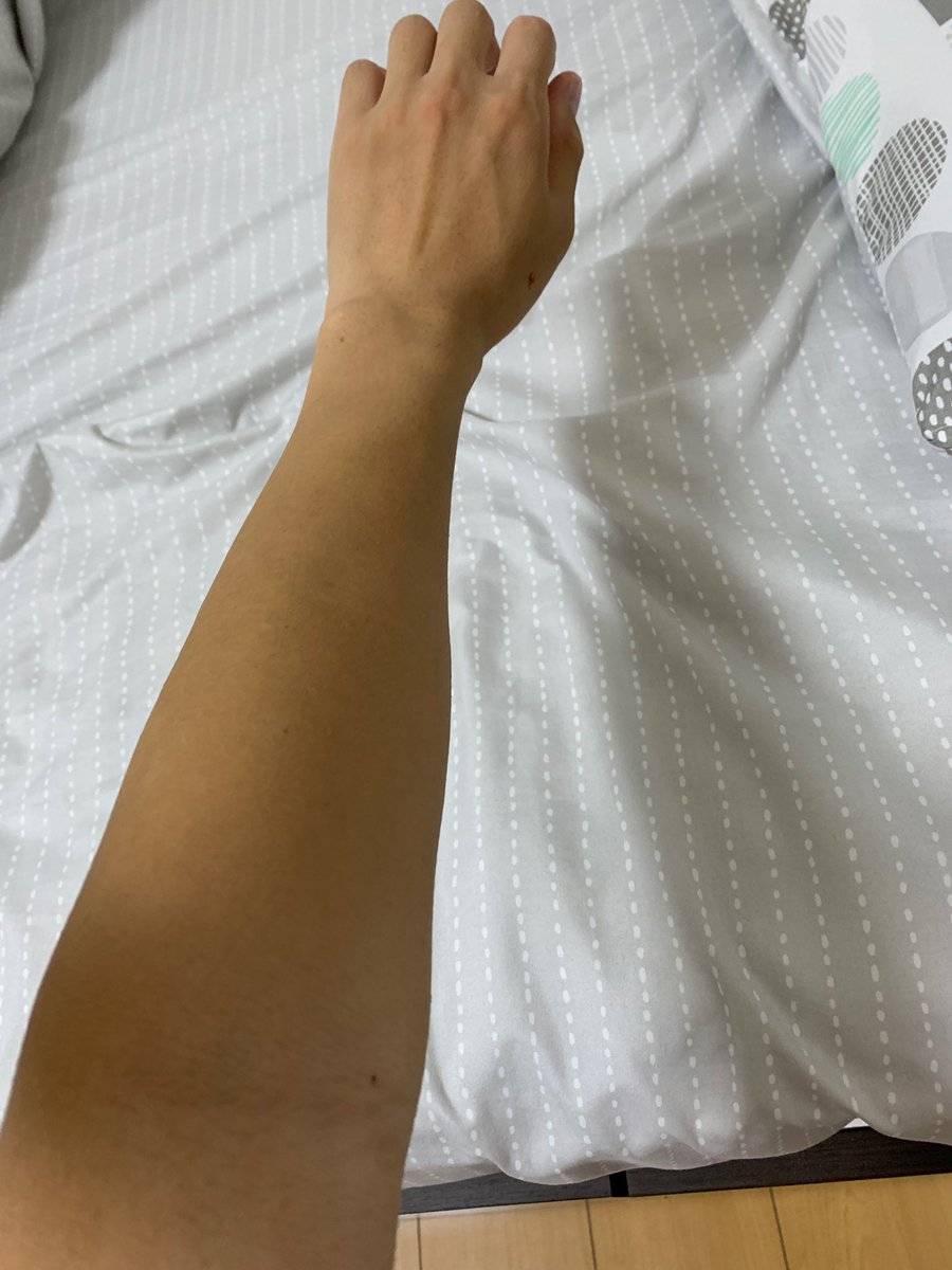 tatsu04a's tweet photo. 脱毛クリームを使い始めて3ヶ月が経ちました。
定期的に使わないと毛は生えてきますが、毎回しっかりツルツルに仕上がるので感動します😊
#ZerofactoR #Zリムーバー #脱毛 https://t.co/TkN3bnTyqc