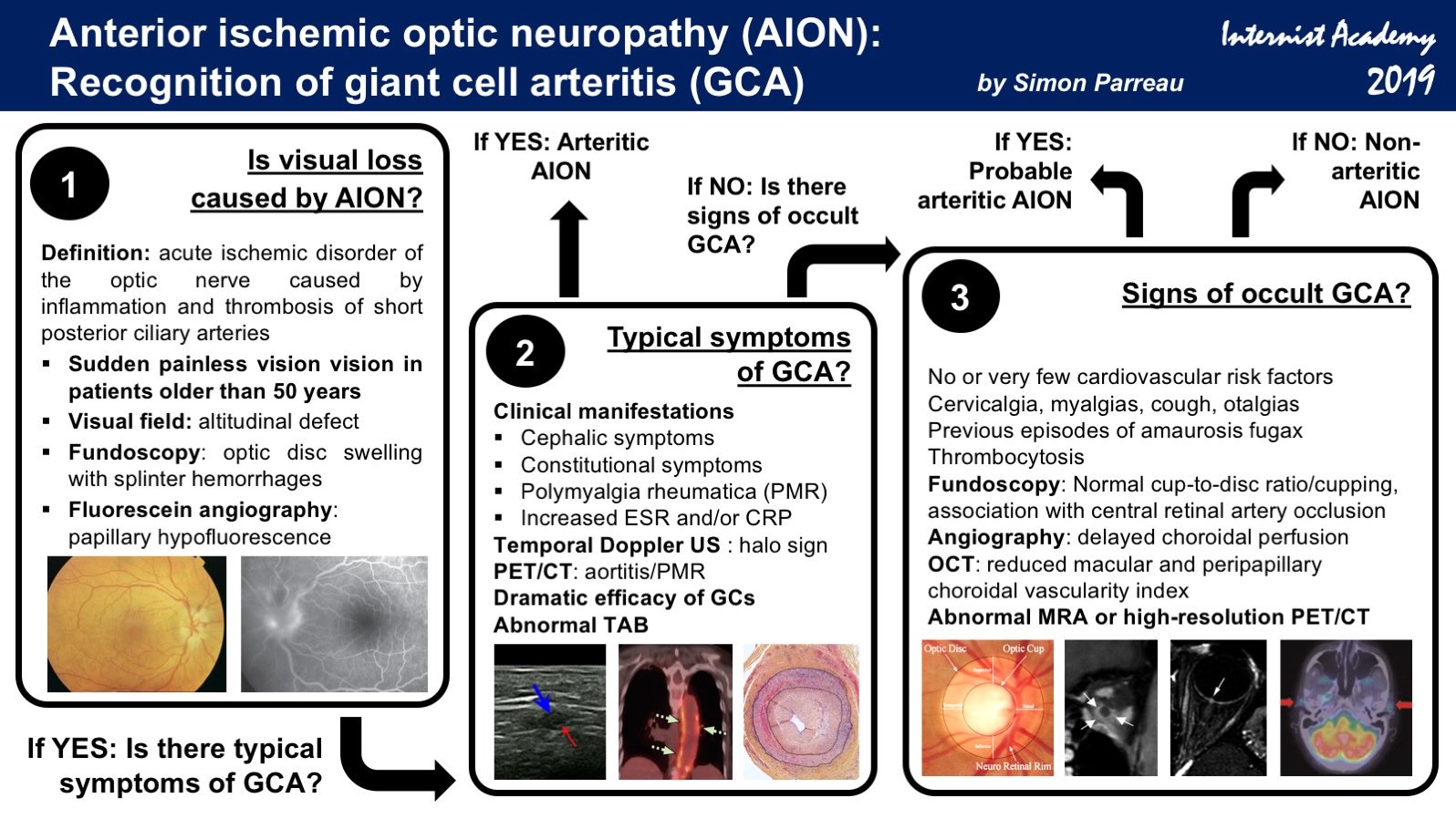 Ischemic Optic Neuropathies