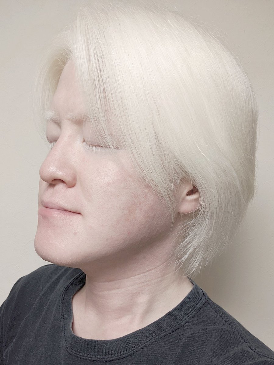 粕谷幸司 Koji Kasuya アルビノ あ そろそろ髪切りたい フォロワーさんの中に アルビノの僕の白い髪を切りたい美容師さんかヘアメークさんがいたら良いのに 長年お願いしていた美容師さんが遠くに移動してしまいましたからねえ Youtube 粕谷幸司 Koji Kasuya アルビノ あ そろそろ髪切りたい フォロワーさんの中に アルビノの僕の白い髪を切りたい美容師さんかヘアメークさんがいたら良いのに 長年お願いしていた美容師さんが遠くに移動してしまいましたからねえ Youtube