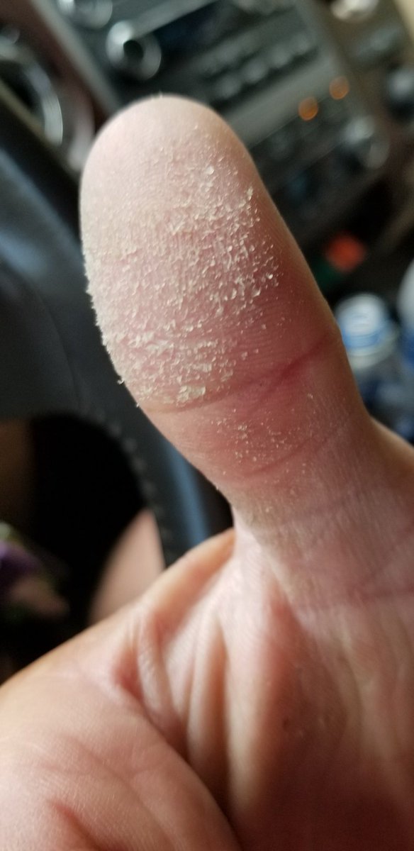 olson_ross's tweet image. Bass thumb, it was a good day!