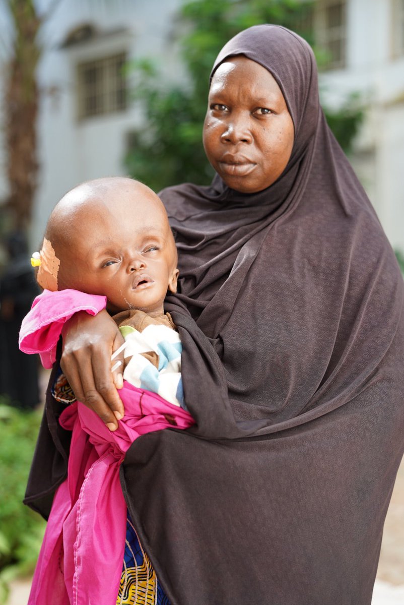 LO HEMOS CONSEGUIDO. Un amigo mío se hace cargo de los costes de la operación de la niña. Todo el equipo de cooperación de #CirujanosPorlaVida llora de la emoción. Nunca hay que perder la esperanza!!!! Mañana más fotos y reportaje 😘