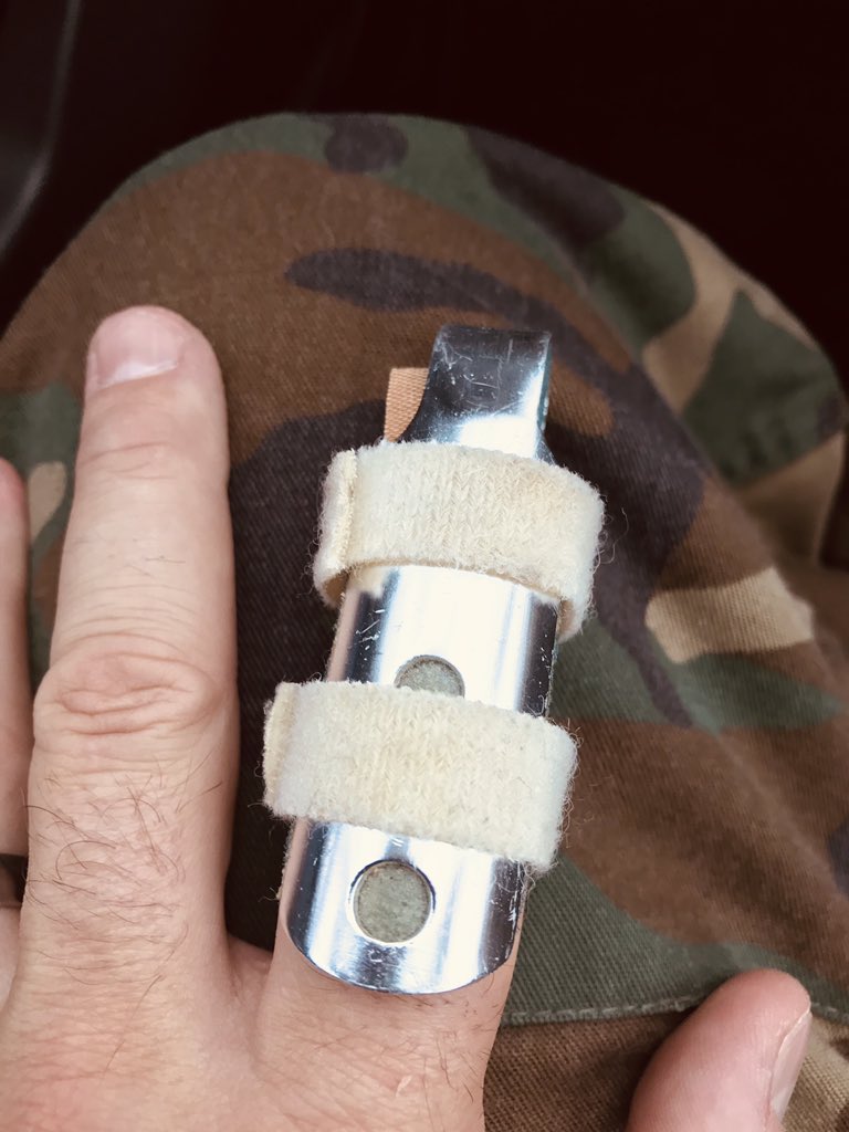 BinyamGYS's tweet photo. Today at practice, my dad filled in at catcher. Broke his finger and gonna lose the nail. Ha. What a knob. https://t.co/bLEis50jor