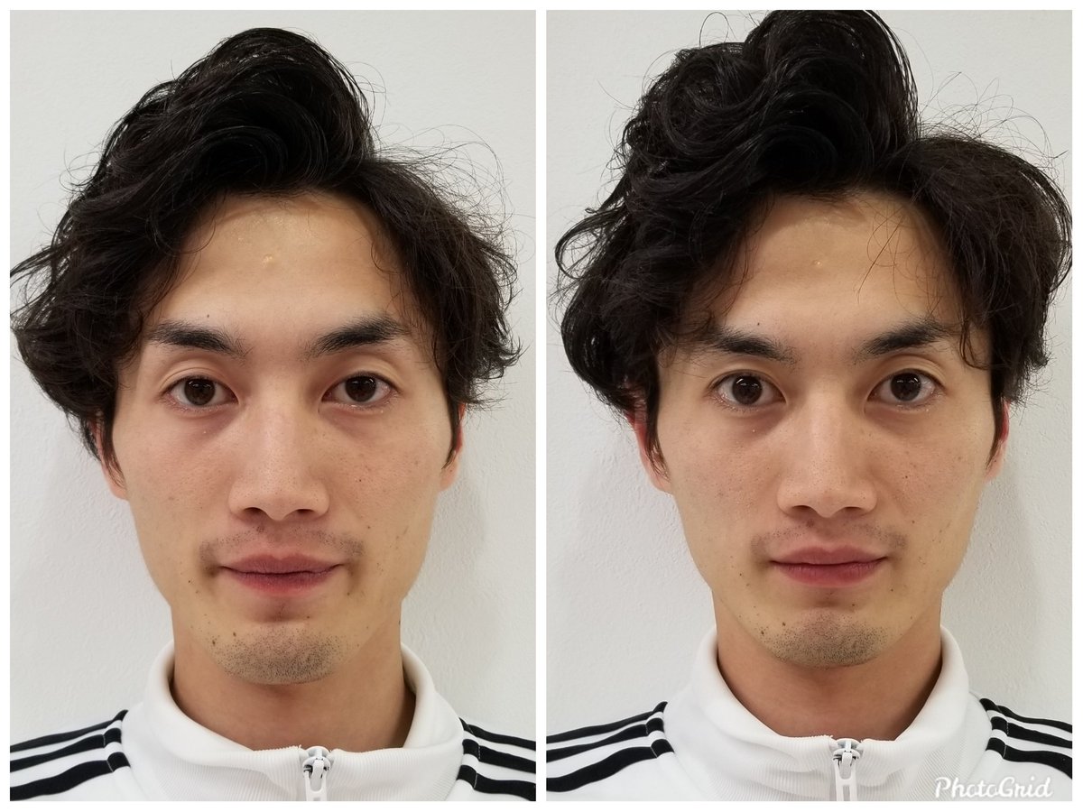 屋良 Auf Twitter 柳店長こんなに小顔ストレッチの効果が出るとは思わなかった 笑 同期で研修生の時から知ってるからこそ 歳を感じました 身体だけでなく お顔もケアしなくちゃね ドクターストレッチ 新小岩 10分 小顔 ストレッチ