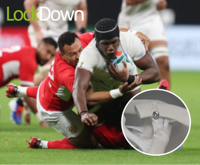 LockDownMedical's tweet photo. The #LockDown device has been successfully used to treat #ACjoint injuries in elite rugby players. These injuries occur frequently in rugby and our device provides a predictable, strong and permanent solution. https://t.co/8igxoq0hRL #rugbyworldcup2019 #acstability #physiotherapy https://t.co/g8QF47V7SB