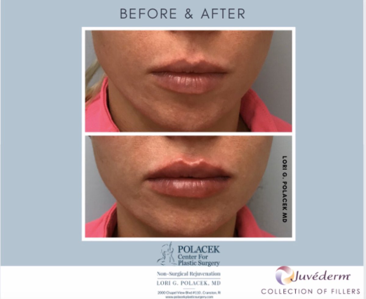 The Polacek Center for Plastic Surgery tweet media