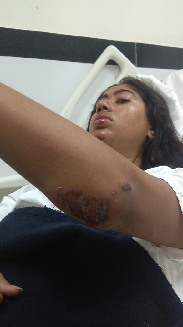 Female journalist working with ANI was attacked by mobile snatchers in CR park area of delhi.she has suffered major injuries. no arrest so far by <a href="/DelhiPolice/">Delhi Police</a> Delhi seems to have become heaven for chain and mobile snatchers. Strict action should be taken asap. <a href="/SwatiJaiHind/">Swati Maliwal</a> <a href="/ANI/">ANI</a>