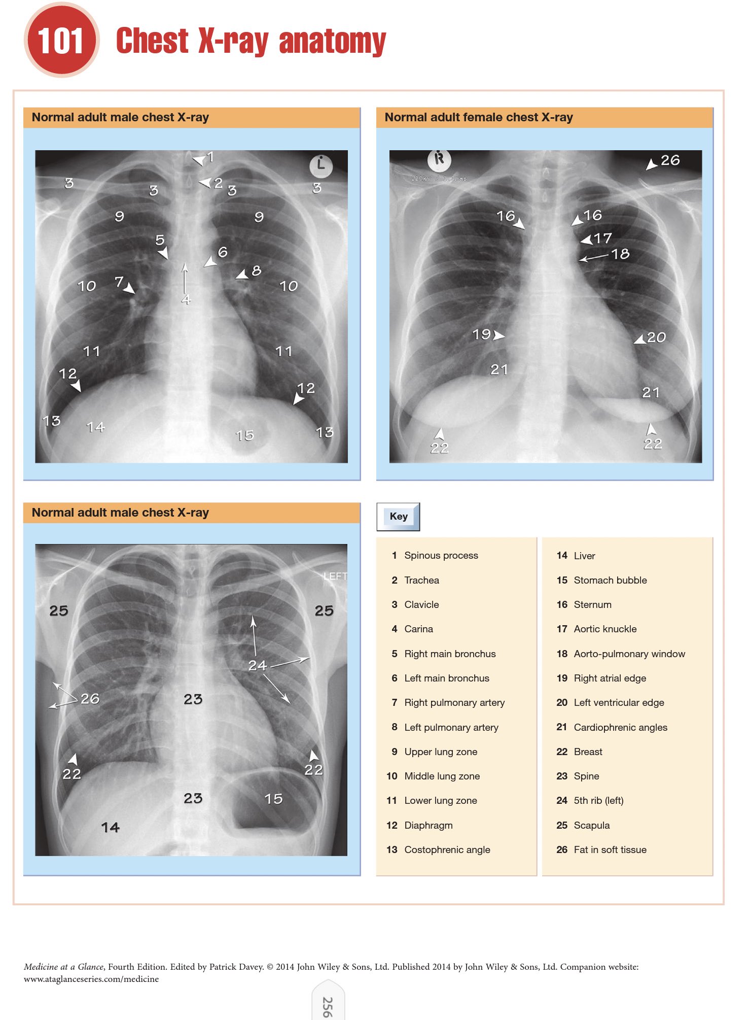 عَالَم الطِّبْ on Twitter "📌Chest xray Anatomy Important anatomical