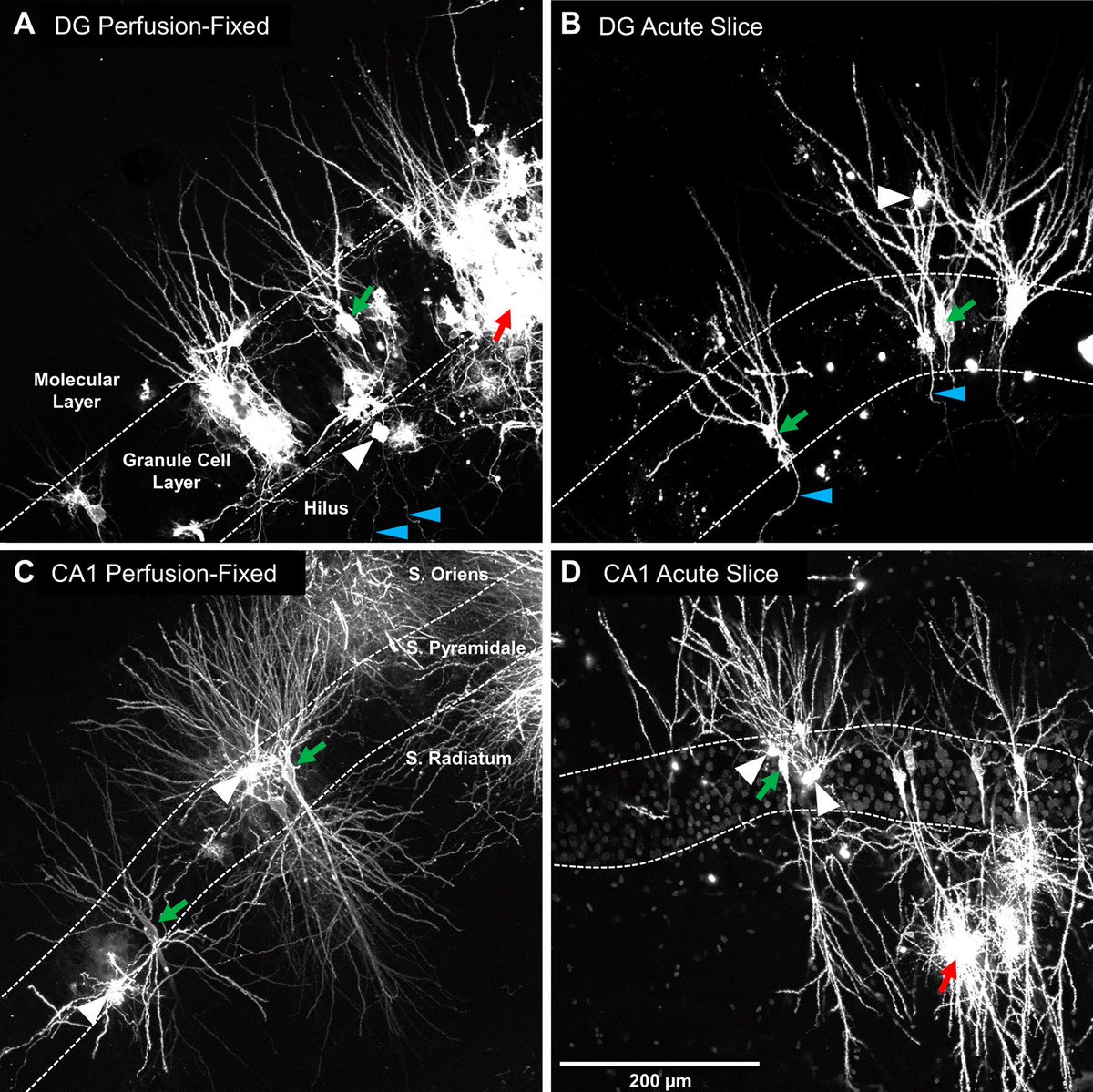 JNP (@jneurophysiol) on Twitter photo New from <a href="/ChristieNeuro/">ChristieNeuroLab</a>:
"Acute slice preparation for electrophysiology increases spine numbers equivalently in the male and female juvenile hippocampus: a DiI labeling study"
J. S. Trivino-Paredes, P. C. Nahirney, C. Pinar, P. Grandes, B. R. Christie
doi.org/10.1152/jn.003… New from <a href="/ChristieNeuro/">ChristieNeuroLab</a>:
"Acute slice preparation for electrophysiology increases spine numbers equivalently in the male and female juvenile hippocampus: a DiI labeling study"
J. S. Trivino-Paredes, P. C. Nahirney, C. Pinar, P. Grandes, B. R. Christie
doi.org/10.1152/jn.003…