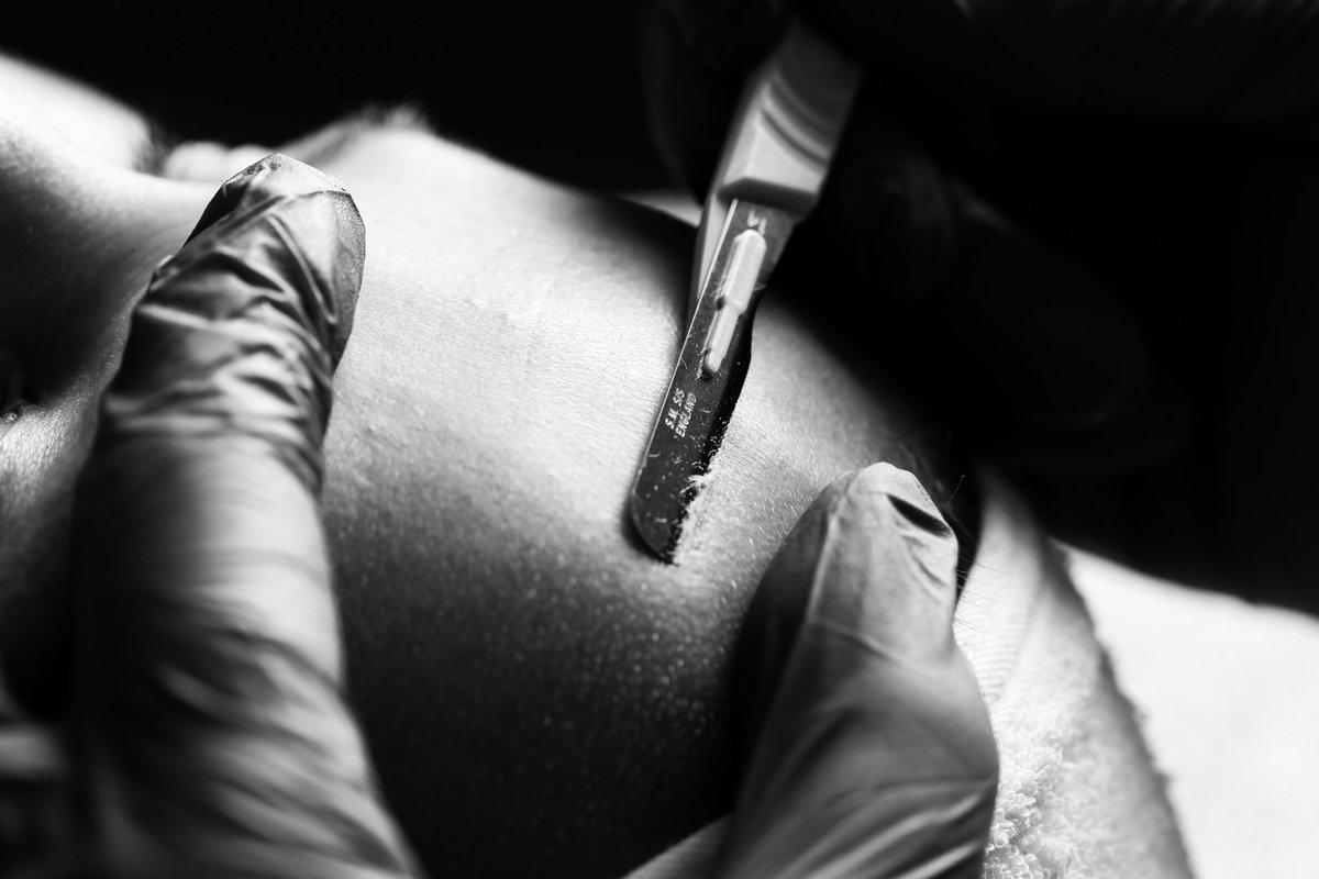 spaodyssey's tweet photo. Absolutely amazing day shooting some new pictures for our Dermaplane Facial Launch in October with Nicola from Body Blitzz!!! #dermaplane #facials #theclinicodyssey #knebworth https://t.co/Sqhuu2sDw4