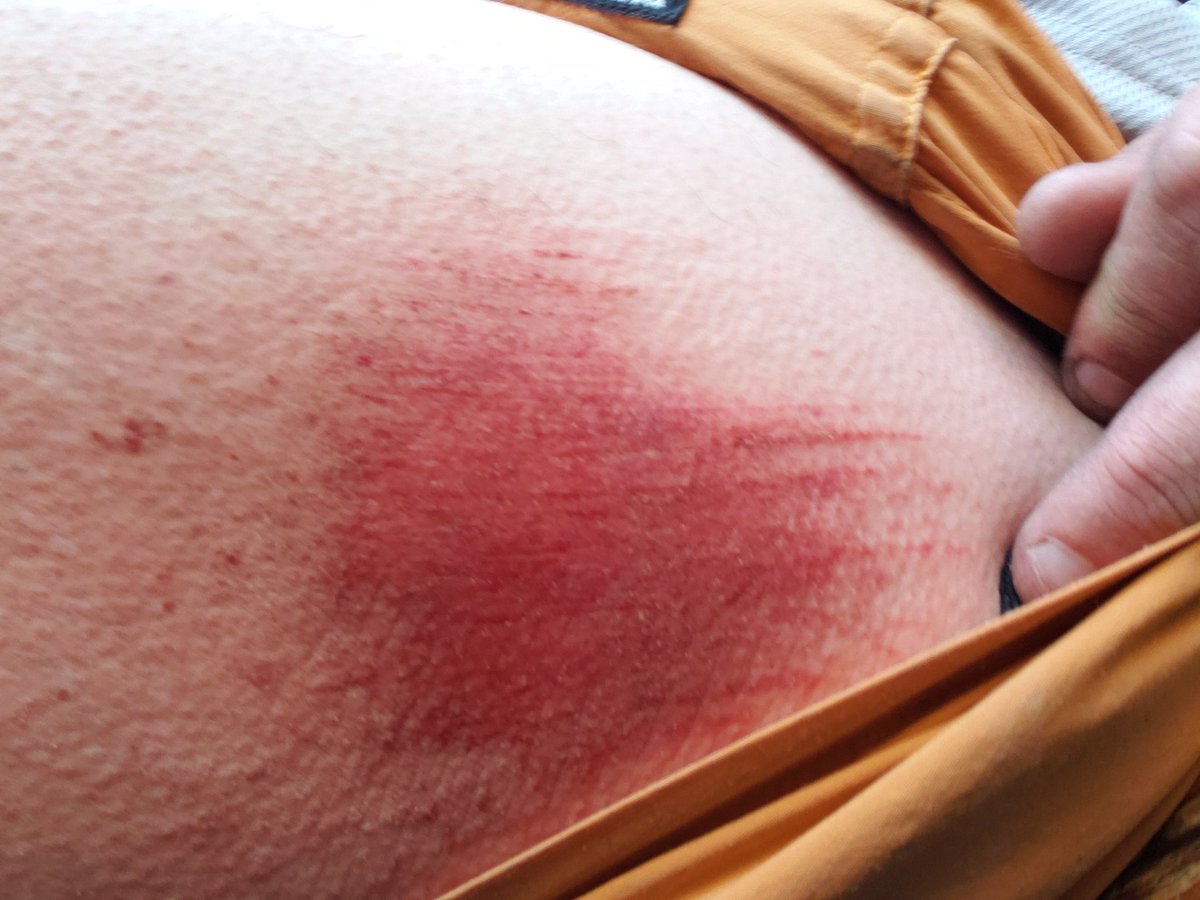 Hayes Permar tweet media