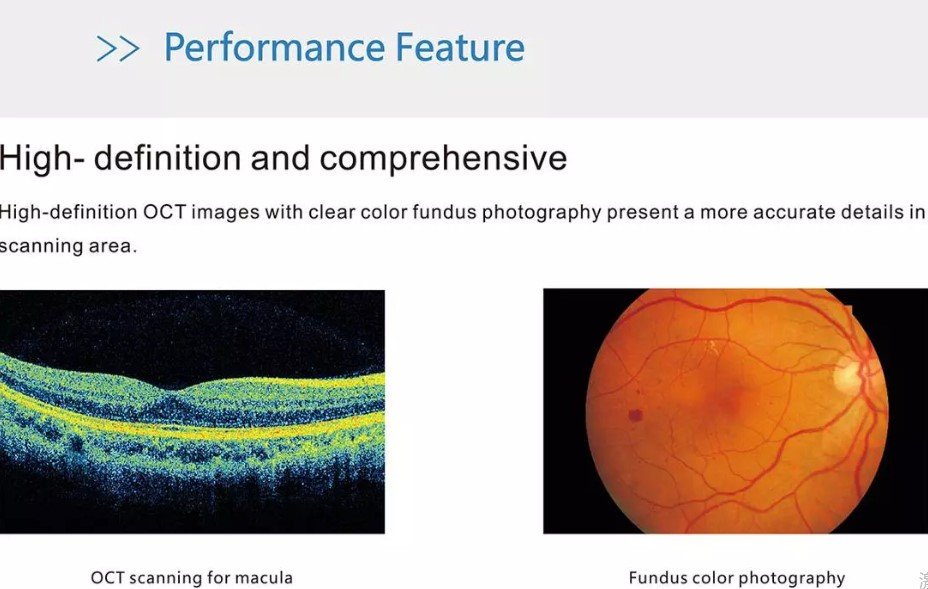 ShangLtd's tweet photo. automatic OCT Optical Coherence Tomography optional external mouse or keyboard https://t.co/asbnFpd51w