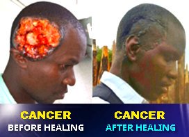 ReubenMbuthia's tweet photo. Most scientists are atheists. In all their studies the cause of cancer is still unknown . That's why it can only be cured by the GOD they claim to them HE is unknown....
Only one scientist by the name DR David Edward Owuor -His GOD is known to cure cancer.
#RepentanceWindow https://t.co/il2ua3DMNW