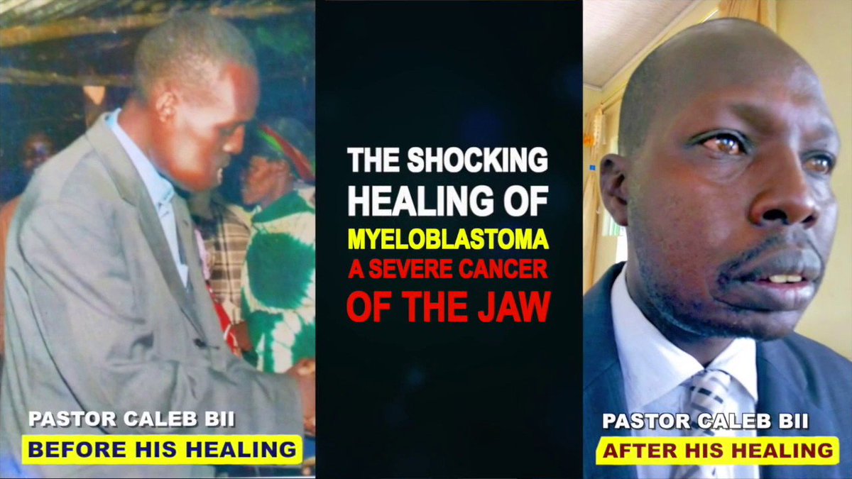ReubenMbuthia's tweet photo. Most scientists are atheists. In all their studies the cause of cancer is still unknown . That's why it can only be cured by the GOD they claim to them HE is unknown....
Only one scientist by the name DR David Edward Owuor -His GOD is known to cure cancer.
#RepentanceWindow https://t.co/il2ua3DMNW