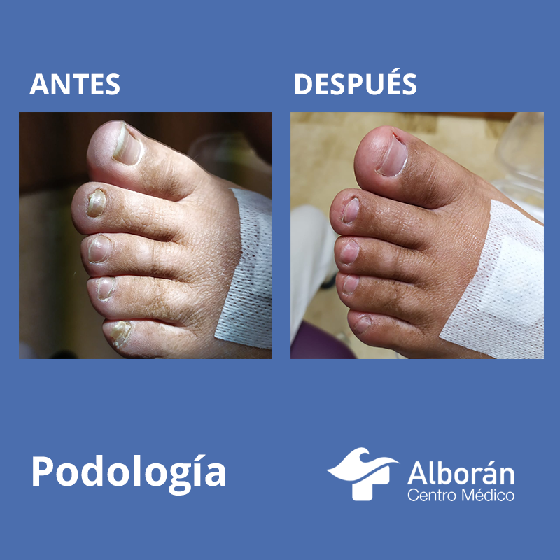 Alboran_CM's tweet photo. Una imagen siempre dice más que mil palabras.

👨‍⚕️ Es crucial la prevención ya que a menudo pequeñas alteraciones estructurales del aparato locomotor van a provocar lesiones que pueden hacerse crónicas.

Pide tu cita ➡️ https://t.co/XRyB7KS9zM https://t.co/eaAwT2w7eb