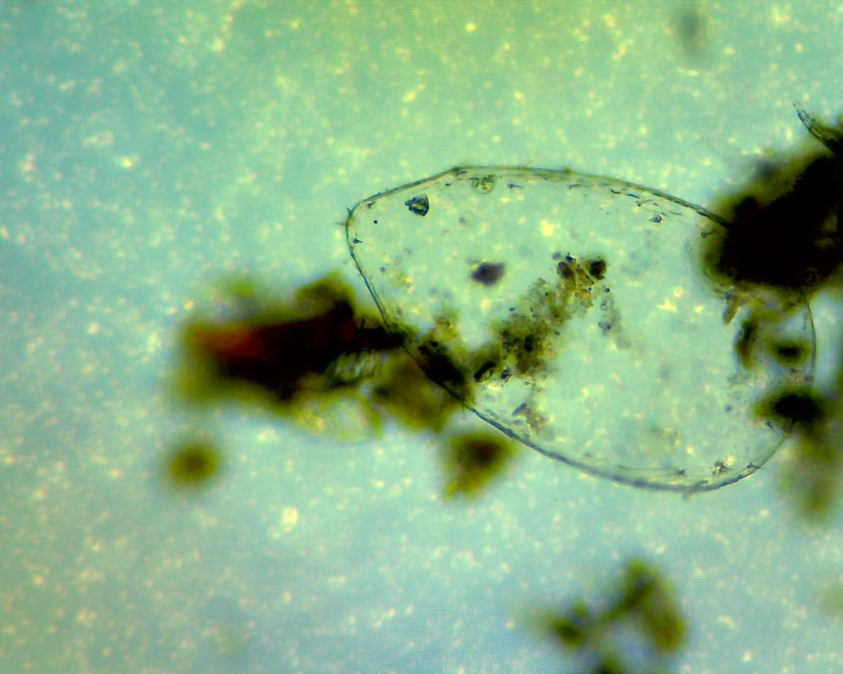 haricovert_'s tweet photo. We still have places left on our @BritishEcolSoc microscope gazing workshop this Saturday @CalthorpeCG. We'll be peering into the world of anaerobic decomposition &amp; fermentation with artists, growers and biologists. More info and tickets here: https://t.co/tAjhgzPYNc https://t.co/0JTBzM4Cek