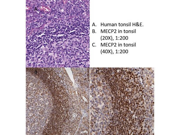 Rockland_Inc's tweet photo. Have you tried our anti-MeCP2? MeCP2 is a chromosomal protein that binds to methyl-CpG dinucleotides, interacts with HDAC and SIN3A to repress transcription, and is useful when studying Rett Syndrome and X-Linked Mental Retardation.
#RocklandAntibodies

https://t.co/x7cmO3YoZ8 https://t.co/RVHY184Vod