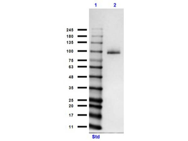 Rockland_Inc's tweet photo. Have you tried our anti-MeCP2? MeCP2 is a chromosomal protein that binds to methyl-CpG dinucleotides, interacts with HDAC and SIN3A to repress transcription, and is useful when studying Rett Syndrome and X-Linked Mental Retardation.
#RocklandAntibodies

https://t.co/x7cmO3YoZ8 https://t.co/RVHY184Vod