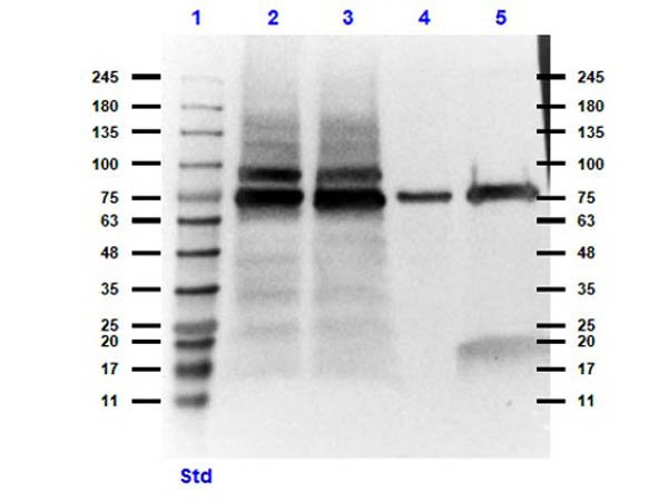Rockland_Inc's tweet photo. Have you tried our anti-MeCP2? MeCP2 is a chromosomal protein that binds to methyl-CpG dinucleotides, interacts with HDAC and SIN3A to repress transcription, and is useful when studying Rett Syndrome and X-Linked Mental Retardation.
#RocklandAntibodies

https://t.co/x7cmO3YoZ8 https://t.co/RVHY184Vod