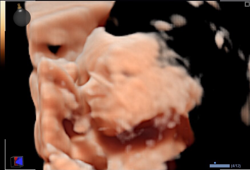 terus sehat dan jadi kuat babyskuy 🚼📹🎞