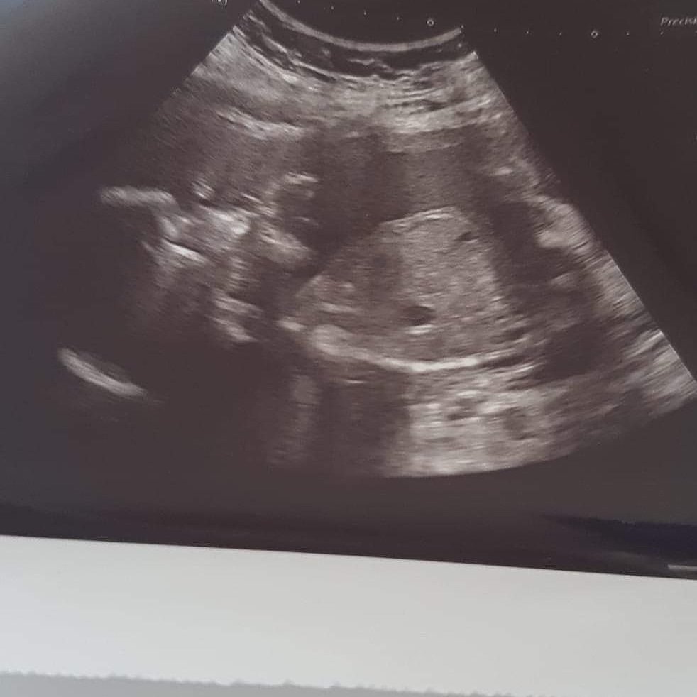 66 days until I meet you mummy's little prince ❤💟👨‍👩‍👧‍👧