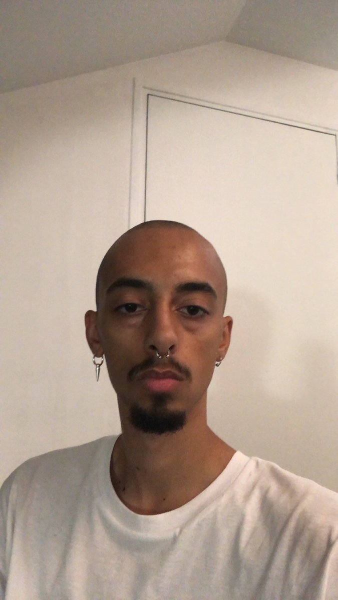 SltCLolo's tweet photo. Visage neutre pour une fois 🤕 https://t.co/pcxnLhh0W5