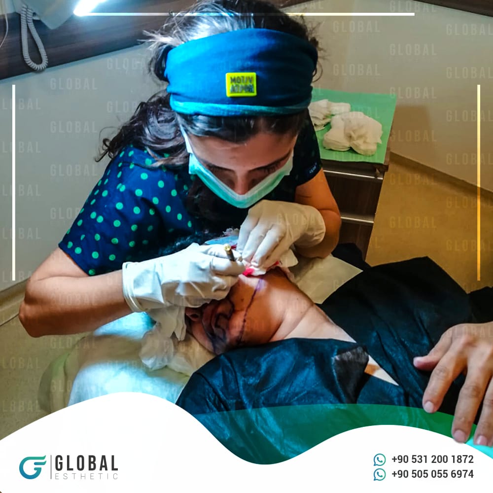 global_esthetic's tweet photo. التخطيط قبل عملية زراعة شعر اللحية 

هيا نحن بانتظارك للتواصل والاستفسارات عبرالواتس اب 👇

https://t.co/0fh5R5FddK
https://t.co/u6OD6CXEzI

#زراعه_الشعر #زراعه_شعر #زراعه_الحواجب #زراعةالشعر #تركيا #مصر #السعودية #الامارات #الكويت #العراق #hair_transplant #hair_transplant_istanb https://t.co/x8cd2Rzqz2