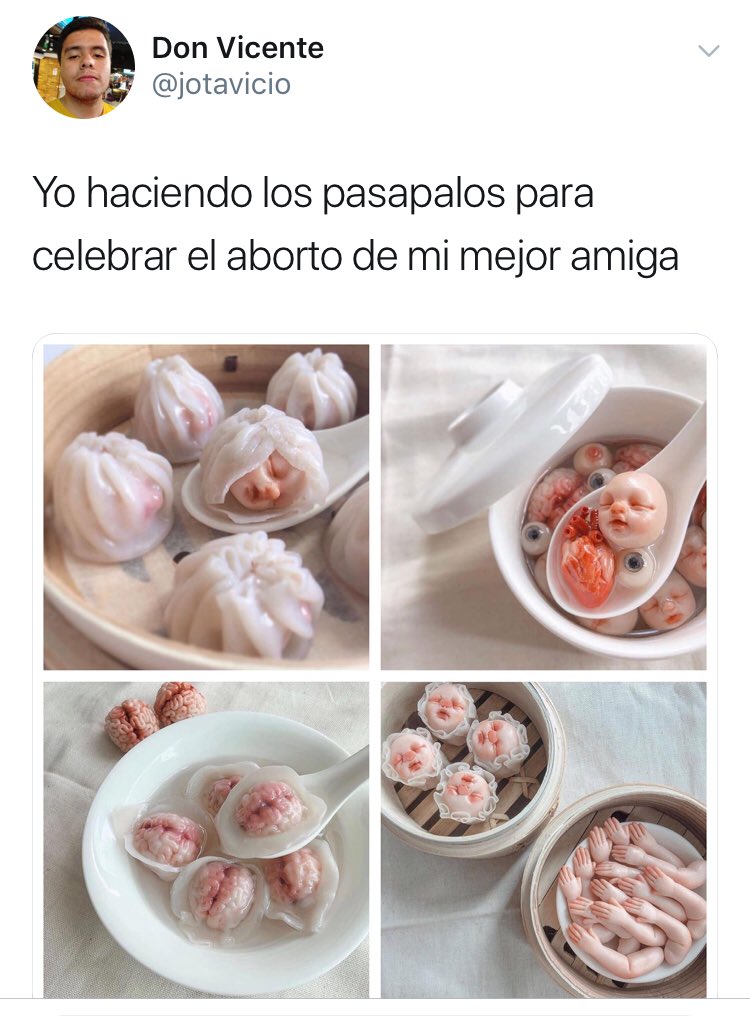 LeandroFlocco's tweet photo. EL ABORTO DESHUMANIZA AL BEBÉ

Es triste ver expresiones como estas, que lejos de dimensionar lo trágico del aborto, prefieren satirizarlo

¿De que sirve ganar el debate legislativo, si perdemos la batalla cultural?

Hay que redoblar esfuezos para lograr una CULTURA DE LA VIDA https://t.co/INyi6WDV90