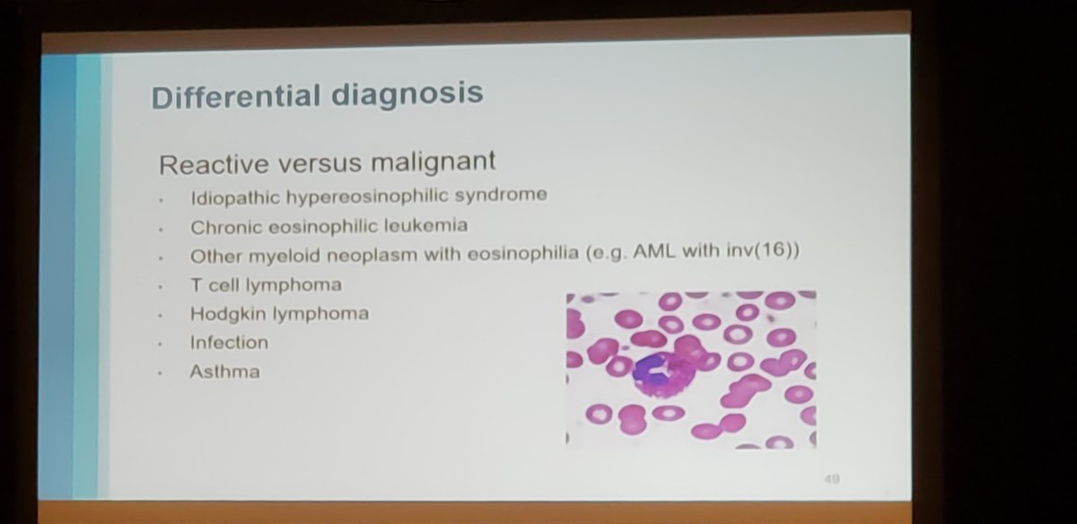 path_smalls's tweet photo. Keep in mind that eosinophilia can be seen in so many diagnoses, so #keepitbroad ! #hemepath @Pathologists @TexPathol @BCM_PathRes #CAP19Orl https://t.co/yY9bfEs99O