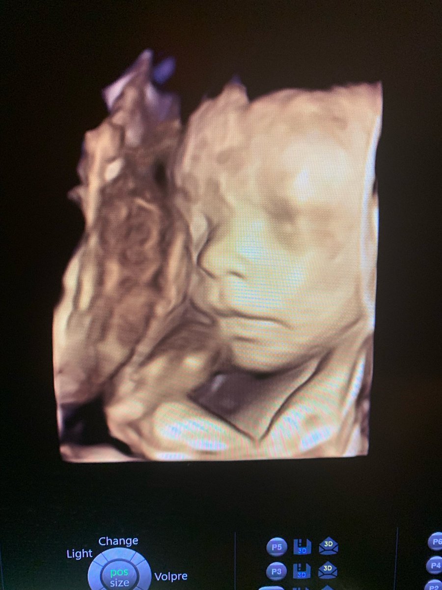 Emma Davies Dixon tweet media