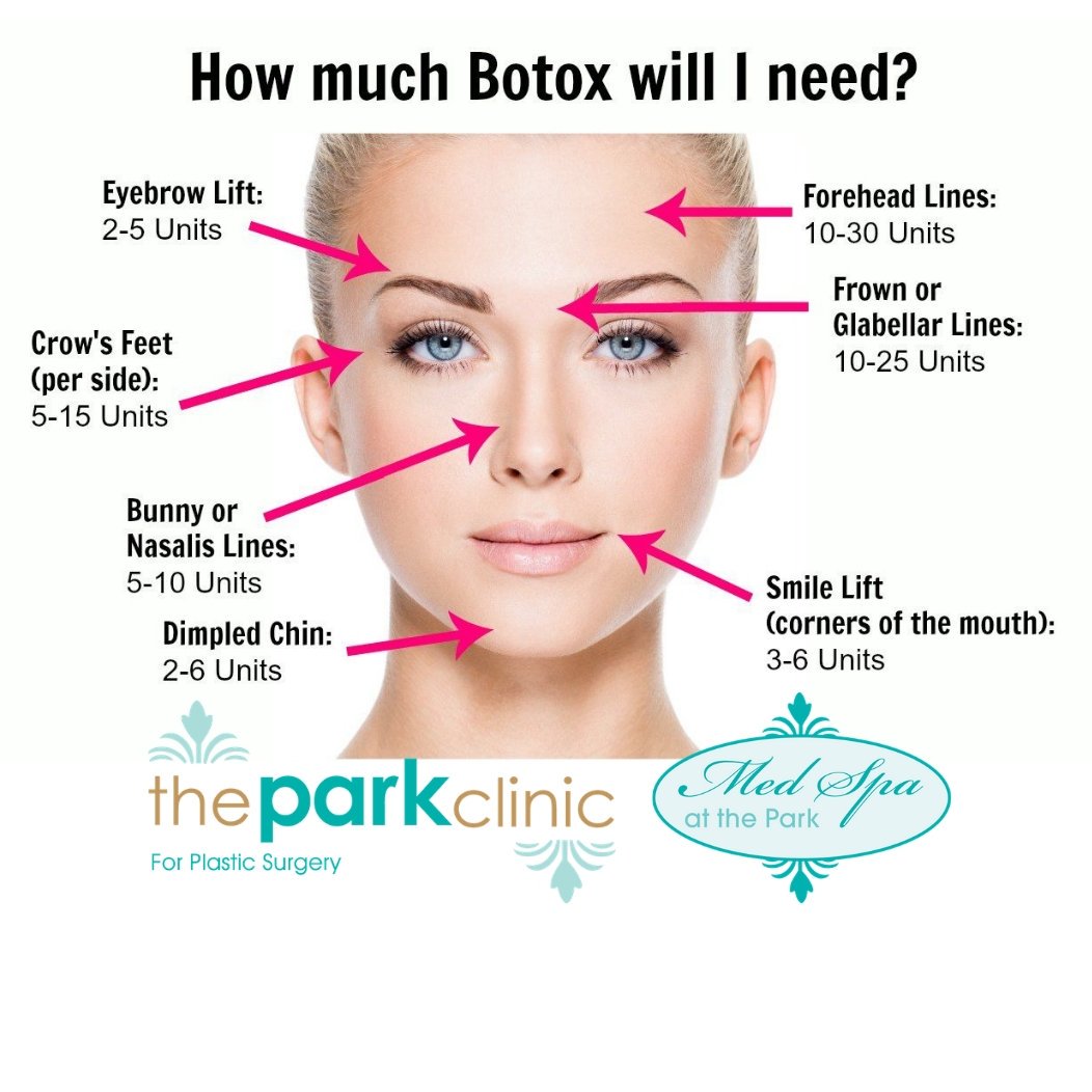 MPRSD's tweet image. The best thing that you can do for crow's feet is a neurotoxin such as Botox. How many units do I need is one of the questions I get asked the most. Here is an estimate for each area you can treat: