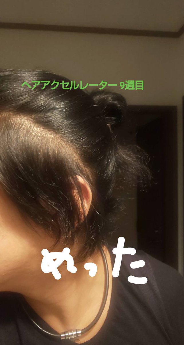 ヘアアクセルレーター