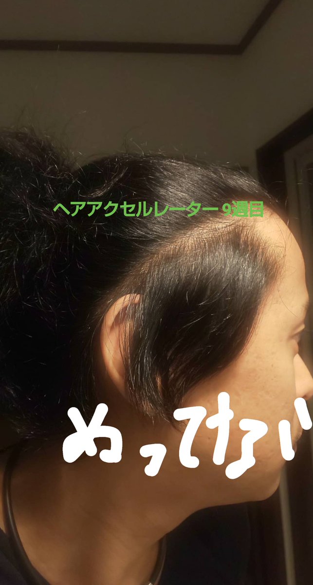 最新 ヘア アクセル レーター 効果 写真 Kamigatahair