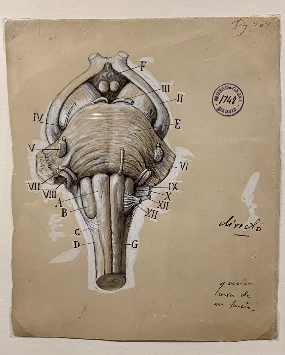 Faith Robertson MD PhD MBA (@faithcrobertson) on Twitter photo Absolutely love Ramon y Cajal. His work truly depicts the beauty of the brain. He was an artist forced to become a doctor by his family - & he married the two to change the field through his astute observations and anatomical drawings. Check out the <a href="/TheJNS/">Journal of Neurosurgery</a> article to learn more Absolutely love Ramon y Cajal. His work truly depicts the beauty of the brain. He was an artist forced to become a doctor by his family - & he married the two to change the field through his astute observations and anatomical drawings. Check out the <a href="/TheJNS/">Journal of Neurosurgery</a> article to learn more