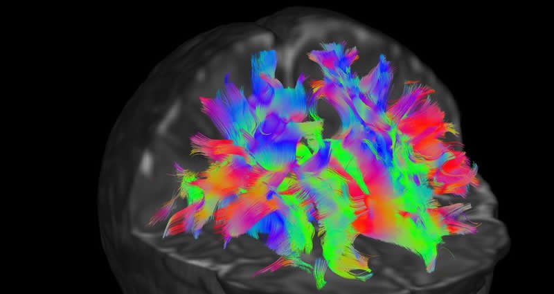 How #Brain wiring &amp; function develops during pregnancy kcl.ac.uk/news/baby-brai… The 'Developing Human Connectome Project' published 500 newborn babies MR brain scans for global researchers to study the developing human brain.<a href="/KingsCollegeLon/">King's College London</a>  <a href="/imperialcollege/">Imperial College London</a> <a href="/UniofOxford/">University of Oxford</a> #dHCP🧠