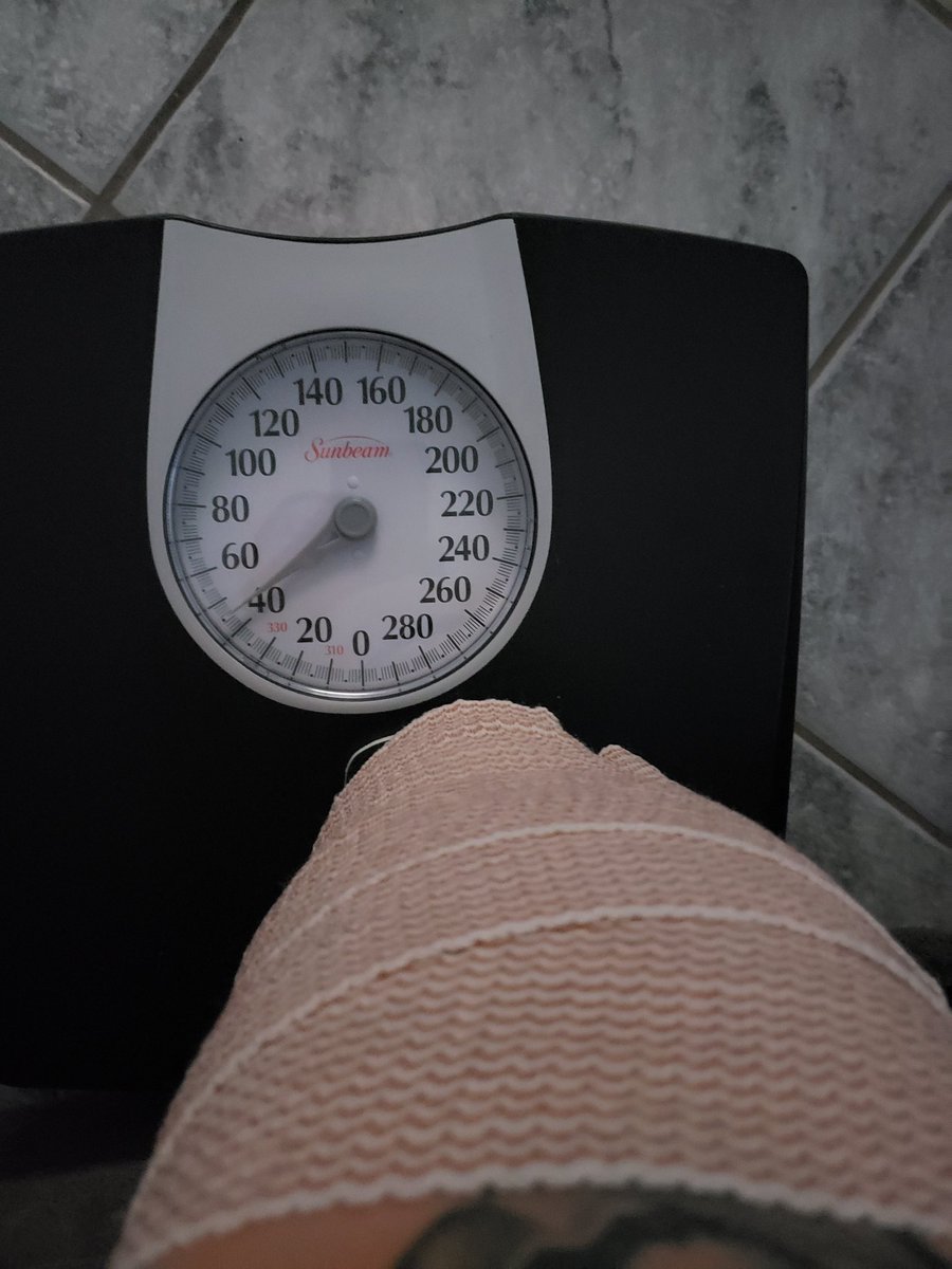 AmputeeCrps's tweet photo. Loading 45lbs on transtibial osseointegration! https://t.co/xmLdAeCYR2