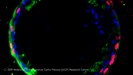 kids_research's tweet photo. Personalised mini-organs are revolutionising treatment in children with #CysticFibrosis, read and listen to @ajaffe1 & @ShafaWaters discuss this on 🎙️ @ABCscience!! Full article here >> https://t.co/HcfWzuvY64 @kids_research @SCHNkids @Sydney_Kids @UNSWObGyn_Paeds https://t.co/7oOLKeYLTp