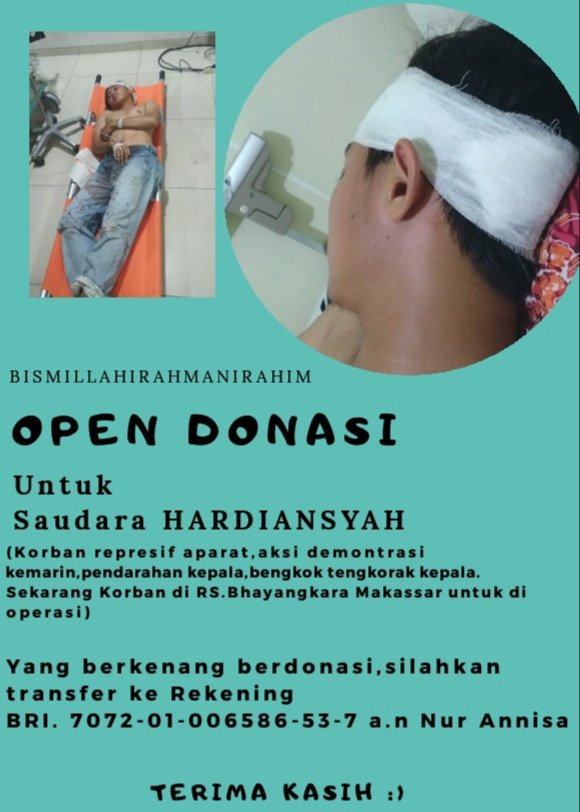 #STMmelawan
Twitter please do your magic!
Kalau ga bisa bntu tunai, rt aja biar yg lain bisa liat dan bergerak hatinya mengulurkan tangan.
Mohon bantuannya 🙏